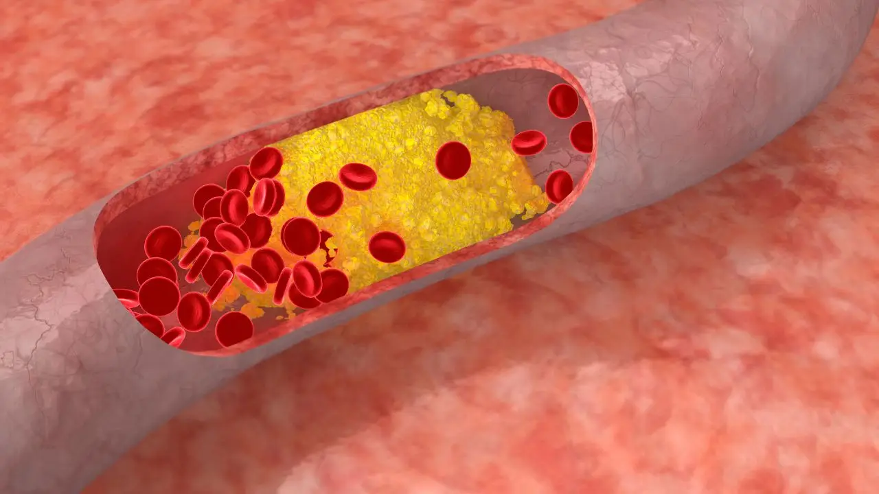 Colesterolo LDL: il frutto che aiuta ad abbassarlo naturalmente Colesterolo LDL: il frutto che aiuta ad abbassarlo naturalmente